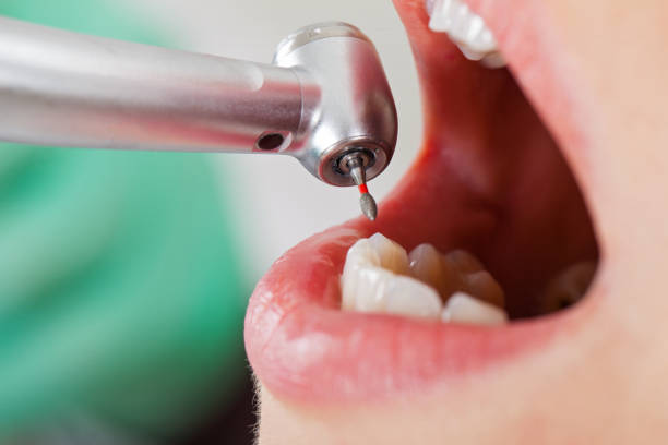 Best Emergency Root Canal Treatment in Tolleson, AZ